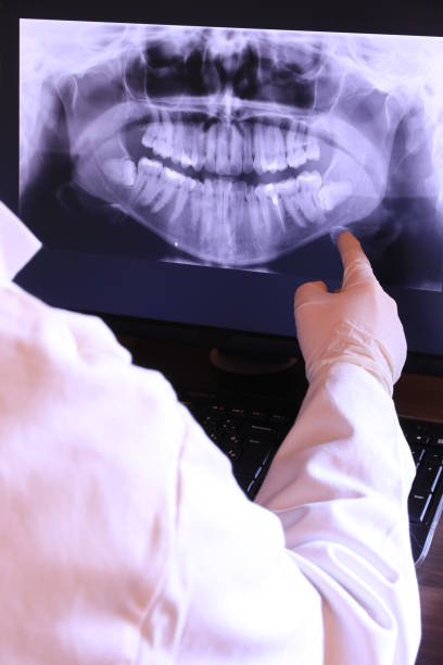 Best Emergency Dental Care for Broken or Chipped Teeth in Sloatsburg, NY
